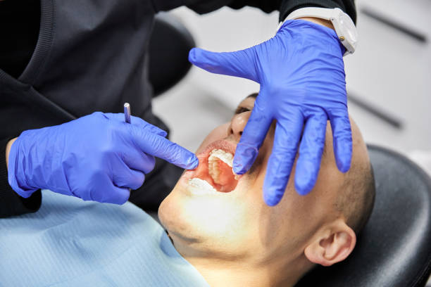 Best Emergency Wisdom Teeth Removal in Andrews, NC